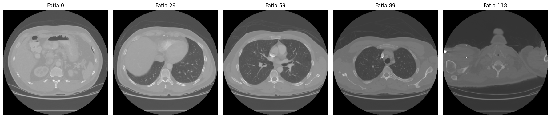 Cinco fatias distribuídas ao longo do volume do CT scan