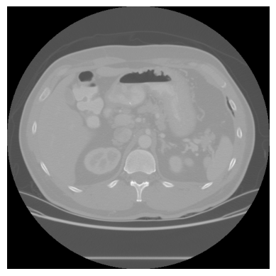 Primeira fatia do CT scan
