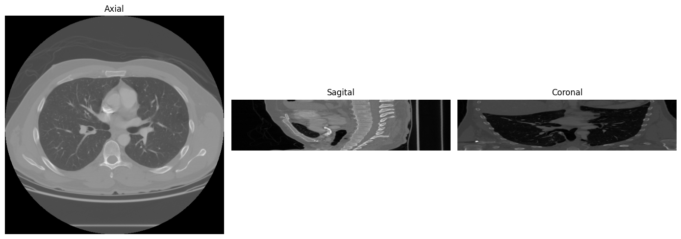 Planos axial, sagital e coronal do CT scan