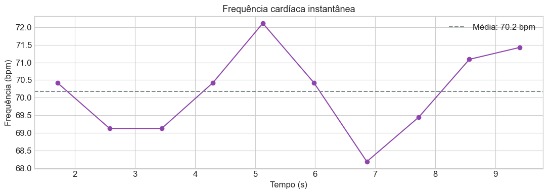 Frequência cardíaca instantânea calculada a partir dos intervalos RR