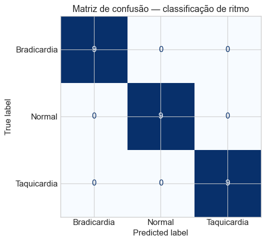 Matriz de confusão da classificação de ritmo cardíaco com Random Forest